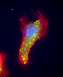 A multicolor microscope image of a cell