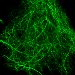 A micrograph of vimentin protein, which appears as a green spider-web against a black background