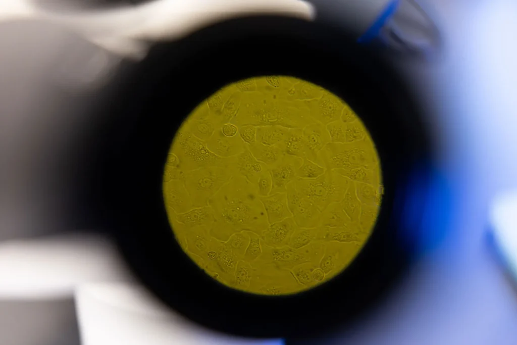 Cervical cell (yellow circle with black exterior)